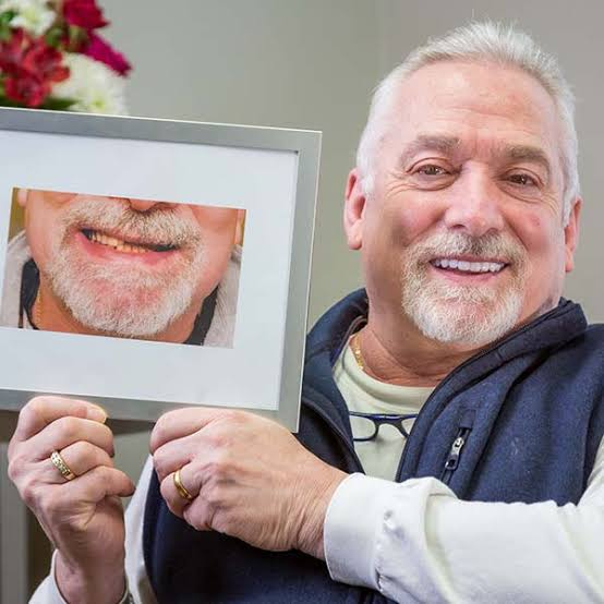 Dental Implants Before and after Oakville Bronte Oak Dental